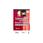 Tuberculosis Of The Skeletal System By SM Tuli