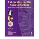 Tuberculosis of the Skeletal System (Bones, Joints, Spine and Bursal Sheaths) by SM Tuli 7/e 2026