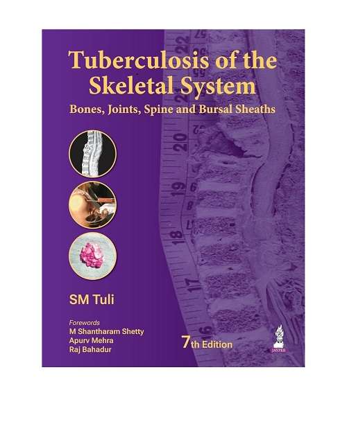 Untitled design (33) Tuberculosis of the Skeletal System (Bones, Joints, Spine and Bursal Sheaths) by SM Tuli 7/e 2026 - Image 1