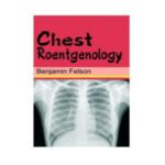 Chest Roentgenology 1st Edition by Benjamin Felson