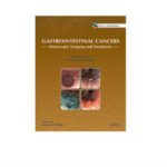 Gastrointestinal Cancers Endoscopic Imaging And Treatment 1st Edition by Prateek Sharma