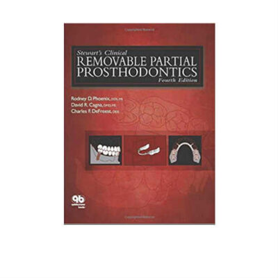Stewart's Clinical Removable Partial Prosthodontics 4th Edition