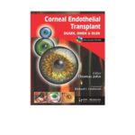 Corneal Endothelial Transplant 1st Edition by Thomas John