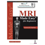 MRI Made Easy (for Beginners) 3/e 2025 by Govind B Chavhan