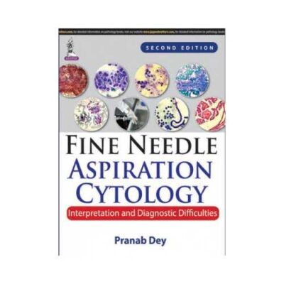 Fine Needle Aspiration Cytology 2015Interpretation And Diagnostic Difficulties2nd edition by Pranab Dey