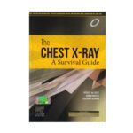 Chest X-Ray A Survival Guide (2020) by Gerald de Lacey