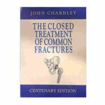 The Closed Treatment Of Common Fractures By John Charnley