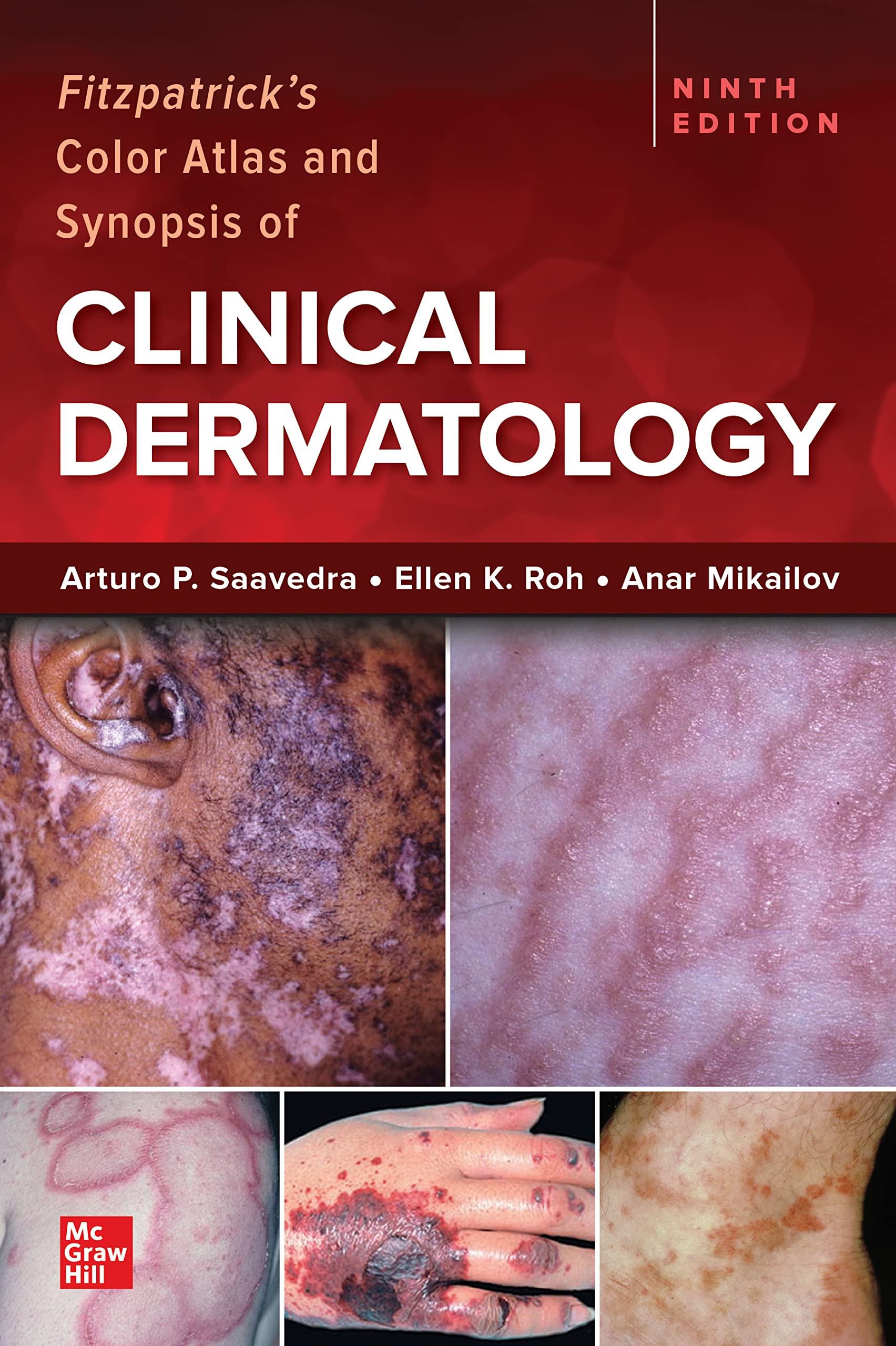 Dermatology　Book　Medical　Atlas　Synopsis　Prithvi　by　Saavedra　9/E　P.　of　Arturo　2023　Clinical　Color　Fitzpatrick's　Store