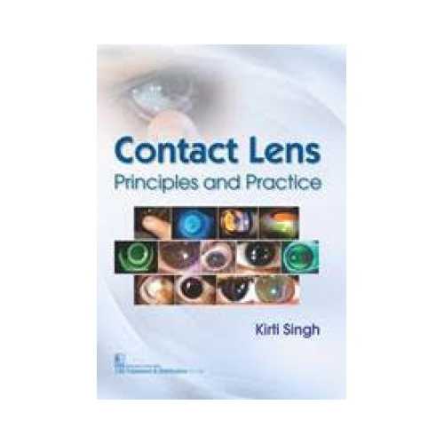 Contact Lens 1st/2017