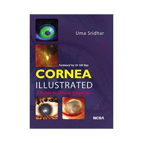 Cornea Illustrated A Guide To Clinical Diagnosis 1st edition by Uma Sridhar