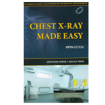 Chest X-Ray Made Easy 5/e 2023 by Jonathan Corne
