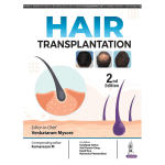 Hair Transplantation by Venkataram Mysore