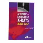 Accident & Emergency X-Rays Made Easy By James D. Begg