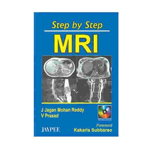 ストア mri 画像 cd