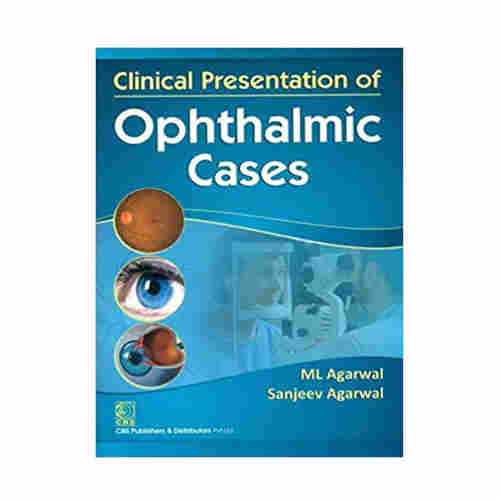 CLINICAL PRESENTATION OF OPTHALMIC CASES By ML Agarwal