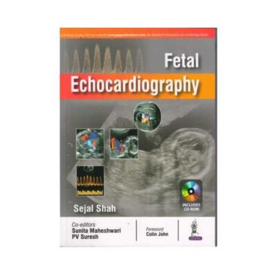Fetal Echocardiography 1st edition by Sejal Shah