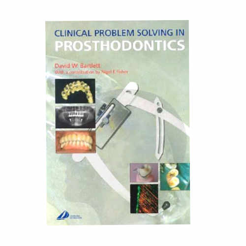 clinical problem solving in prosthodontics