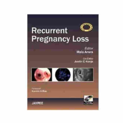 Recurrent Pregnancy Loss By Mala Arora