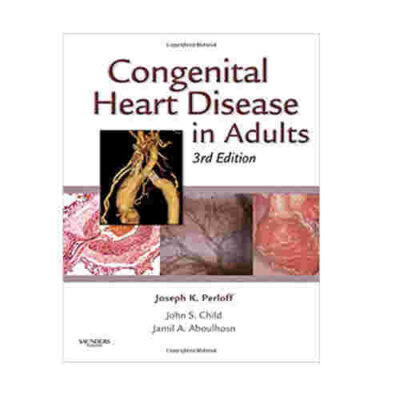 Congenital Heart Disease in Adults By Joseph K. Perloff