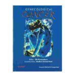 Gynecological Cancer By CN Purandare