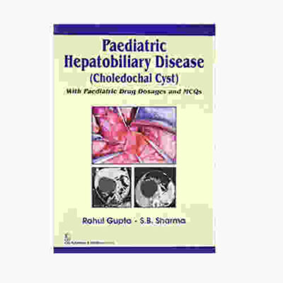 PAEDIATRIC HEPATOBILIARY DISEASE (CHOLEDOCHAL CYST) WITH PAEDIATRIC DRUG DOSAGES AND MCQS By Rahul Gupta