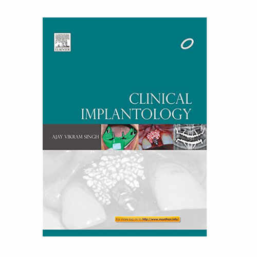 Clinical Implantology By Ajay Vikram Singh