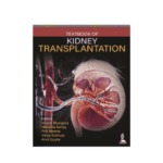Textbook of Kidney Transplantation by Vinant Bhargava