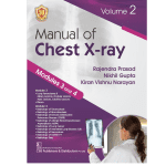 Manual of Chest X-ray, Vol 2 ( Modules 3 and 4 ) 2024 By Rajendra Prasad