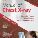 Manual of Chest X-ray, Volume 1, ( Modules 1 and 2 ) 1/E (PB 2024) by Rajendra Prasad