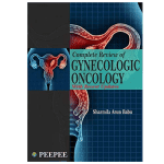 Complete Review of Gynecologic Oncology 1ed 2021 by Dr. Sharmila Arun Babu