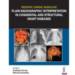 Pediatric Cardiac Radiology Plain Radiographic Interpretation in Congenital and Structural Heart Diseases 1/e 2024 by Sudeep Verma