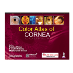 Color Atlas of Cornea 1/e 2024 by Sujatha Mohan