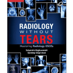Radiology Without Tears: Mastering Radiology OSCEs 1/e 2025 by Satyendra Raghuwanshi