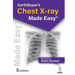 Karthikeyan's Chest X-Ray Made Easy 3/e 2025