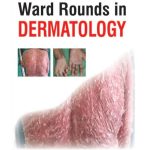 Ward Rounds in Dermatology 1/e 2024 by M.D. Shah, Bela J
