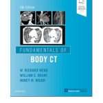 Fundamentals of Body CT by W Richard Webb 5/e 2020