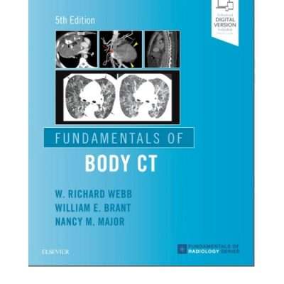 Fundamentals of Body CT by W Richard Webb 5/e 2020